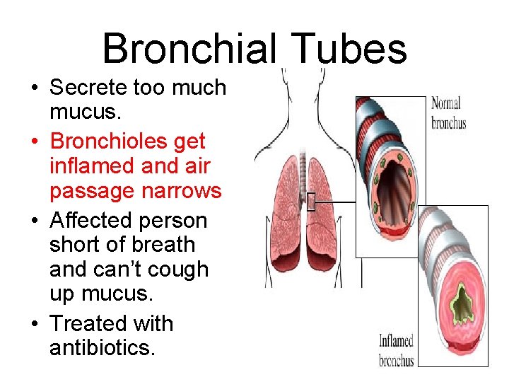 Bronchial Tubes • Secrete too much mucus. • Bronchioles get inflamed and air passage