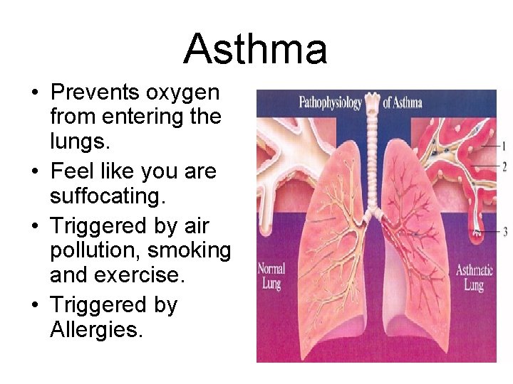 Asthma • Prevents oxygen from entering the lungs. • Feel like you are suffocating.