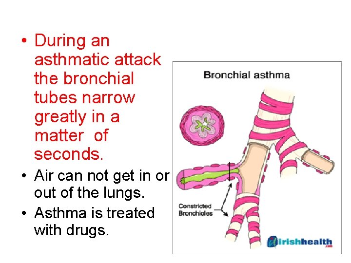  • During an asthmatic attack the bronchial tubes narrow greatly in a matter