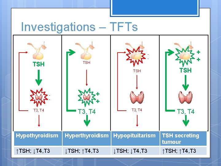 Investigations – TFTs TSH T 3, T 4 + + T 3, T 4