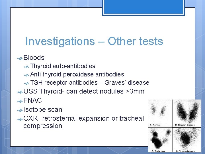 Investigations – Other tests Bloods Thyroid auto-antibodies Anti thyroid peroxidase antibodies TSH receptor antibodies