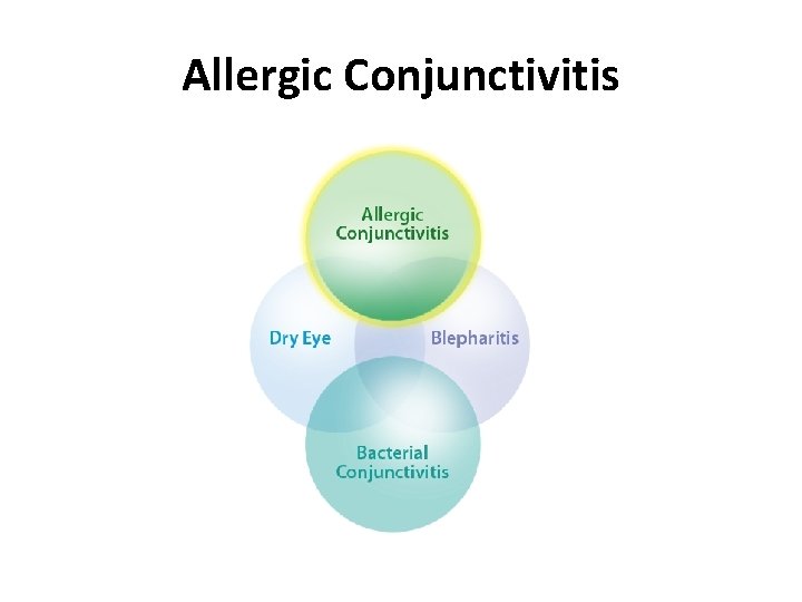 Allergic Conjunctivitis 