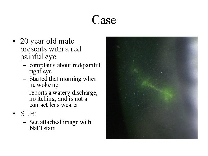 Case • 20 year old male presents with a red painful eye – complains