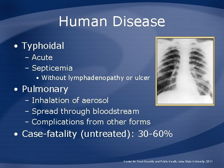 Human Disease • Typhoidal – Acute – Septicemia • Without lymphadenopathy or ulcer •