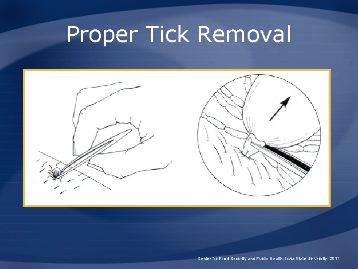 Proper Tick Removal Center for Food Security and Public Health, Iowa State University, 2011