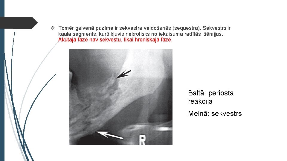  Tomēr galvenā pazīme ir sekvestra veidošanās (sequestra). Sekvestrs ir kaula segments, kurš kļuvis