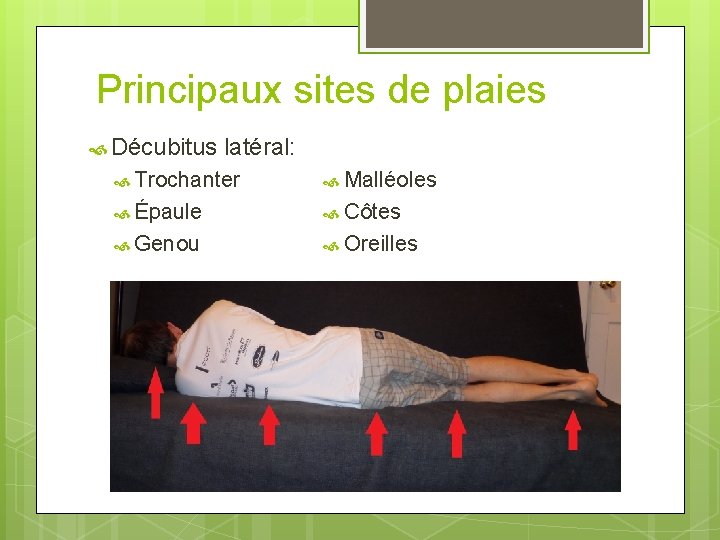 Principaux sites de plaies Décubitus latéral: Trochanter Malléoles Épaule Côtes Genou Oreilles 