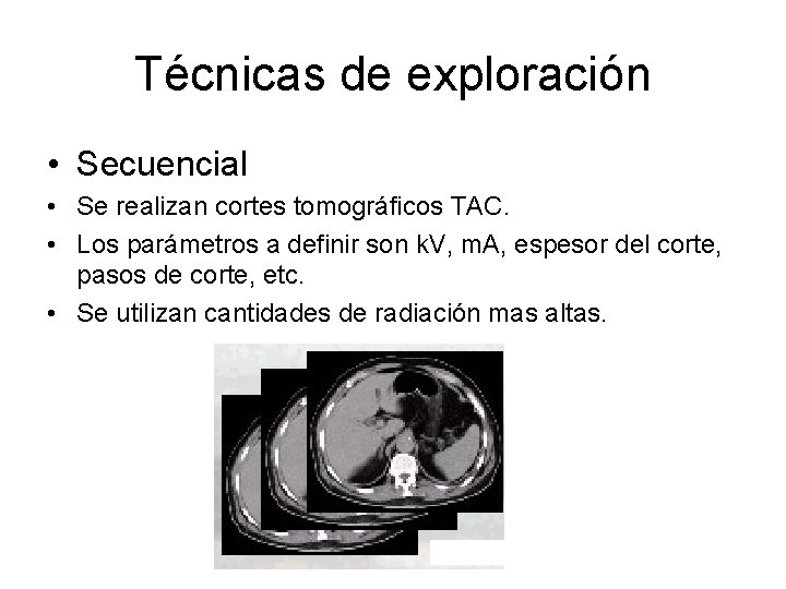 Técnicas de exploración • Secuencial • Se realizan cortes tomográficos TAC. • Los parámetros