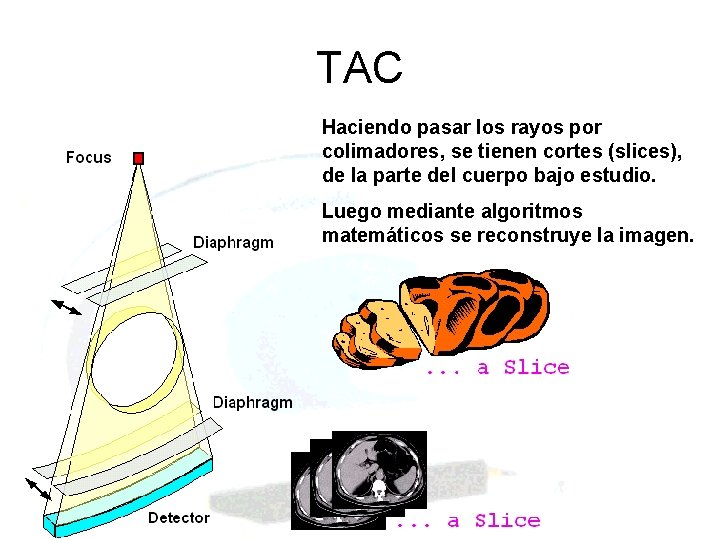 TAC Haciendo pasar los rayos por colimadores, se tienen cortes (slices), de la parte