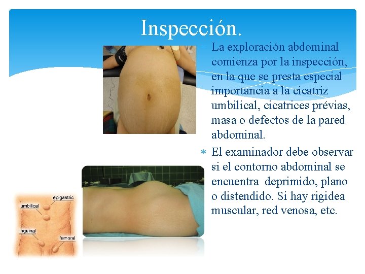 Inspección. La exploración abdominal comienza por la inspección, en la que se presta especial