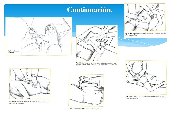 Continuación. 