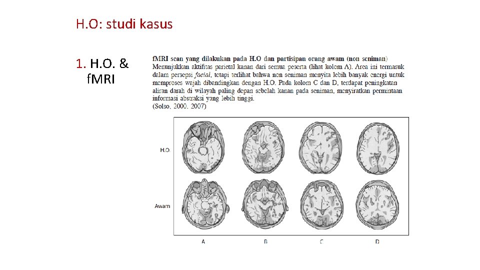 H. O: studi kasus 1. H. O. & f. MRI 