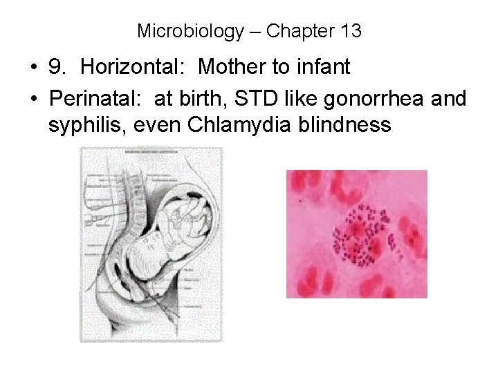 Microbiology – Chapter 13 • 9. Horizontal: Mother to infant • Perinatal: at birth,