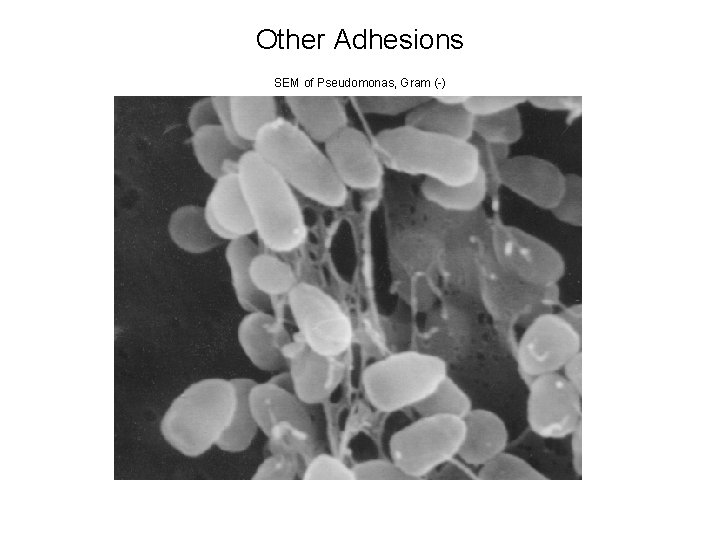 Other Adhesions SEM of Pseudomonas, Gram (-) 