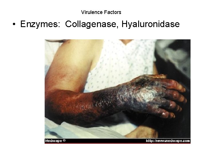 Virulence Factors • Enzymes: Collagenase, Hyaluronidase 