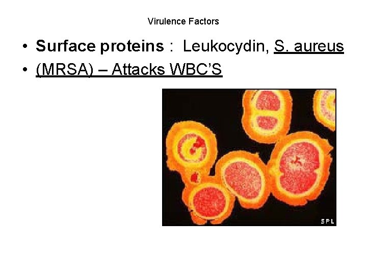 Virulence Factors • Surface proteins : Leukocydin, S. aureus • (MRSA) – Attacks WBC’S