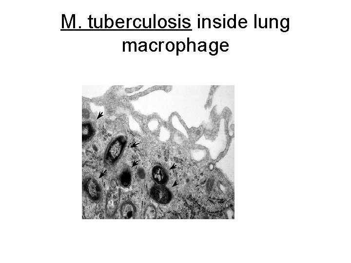 M. tuberculosis inside lung macrophage 