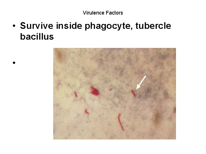 Virulence Factors • Survive inside phagocyte, tubercle bacillus • 
