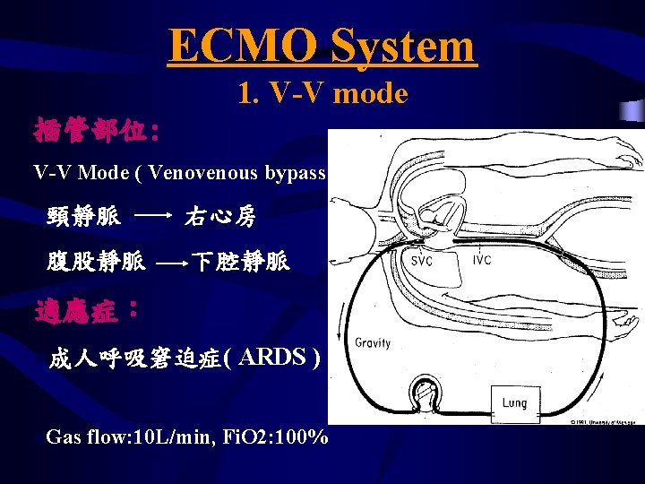 ECMO System 1. V-V mode 插管部位: V-V Mode ( Venovenous bypass mode ) 頸靜脈