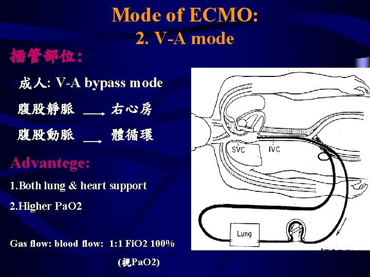 Mode of ECMO: 插管部位: l成人: 2. V-A mode V-A bypass mode 腹股靜脈 右心房 腹股動脈