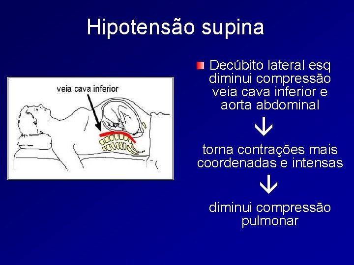 Hipotensão supina Decúbito lateral esq diminui compressão veia cava inferior e aorta abdominal torna
