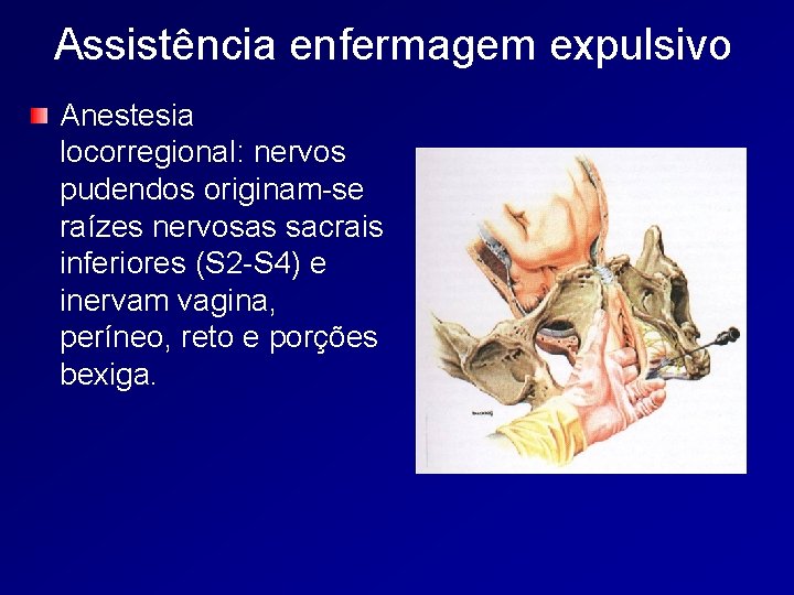 Assistência enfermagem expulsivo Anestesia locorregional: nervos pudendos originam-se raízes nervosas sacrais inferiores (S 2