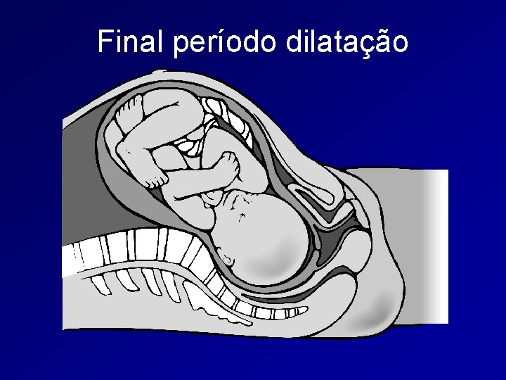 Final período dilatação 