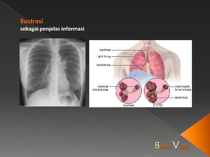Ilustrasi sebagai penjelas informasi B AHASA V ISUAL 