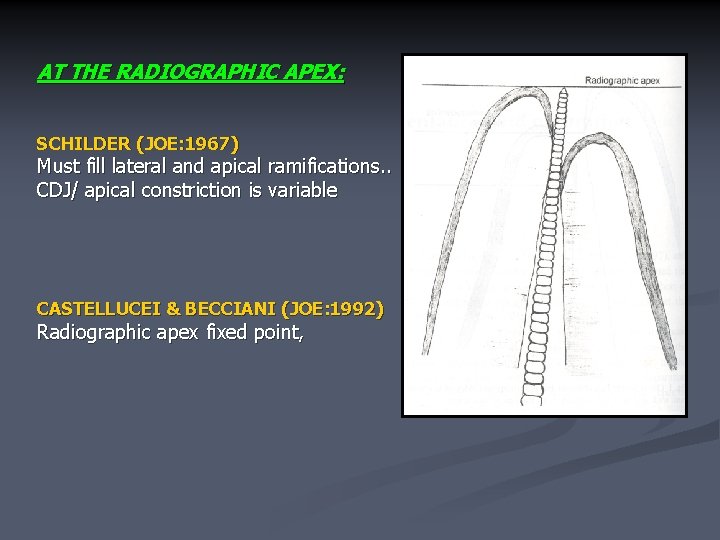 AT THE RADIOGRAPHIC APEX: SCHILDER (JOE: 1967) Must fill lateral and apical ramifications. .