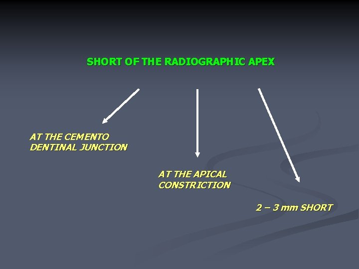 SHORT OF THE RADIOGRAPHIC APEX AT THE CEMENTO DENTINAL JUNCTION AT THE APICAL CONSTRICTION