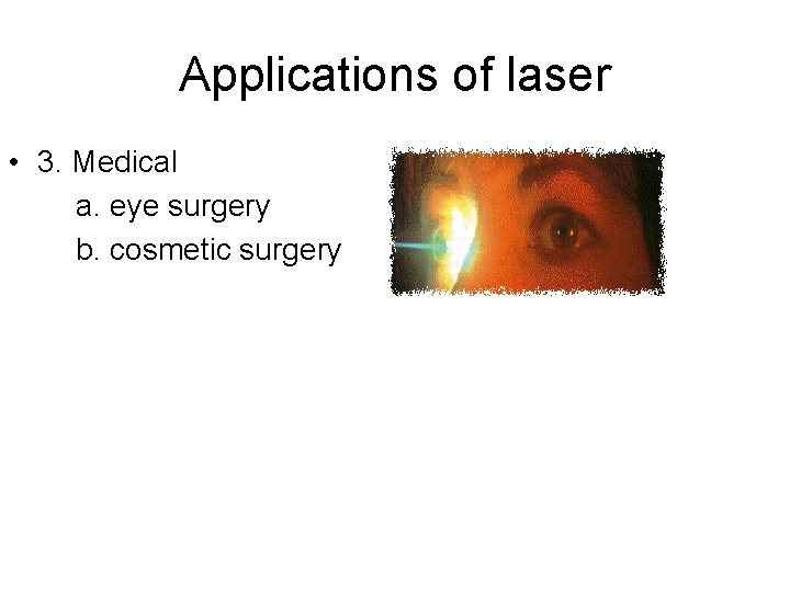 Applications of laser • 3. Medical a. eye surgery b. cosmetic surgery 