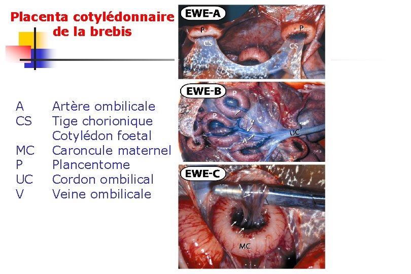 Placenta cotylédonnaire de la brebis A CS MC P UC V Artère ombilicale Tige