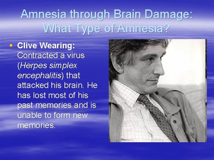 Amnesia through Brain Damage: What Type of Amnesia? § Clive Wearing: Contracted a virus
