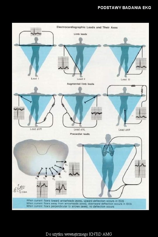 PODSTAWY BADANIA EKG Do użytku wewnętrznego KNTi. D AMG 
