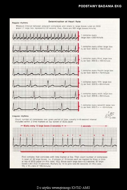PODSTAWY BADANIA EKG Do użytku wewnętrznego KNTi. D AMG 