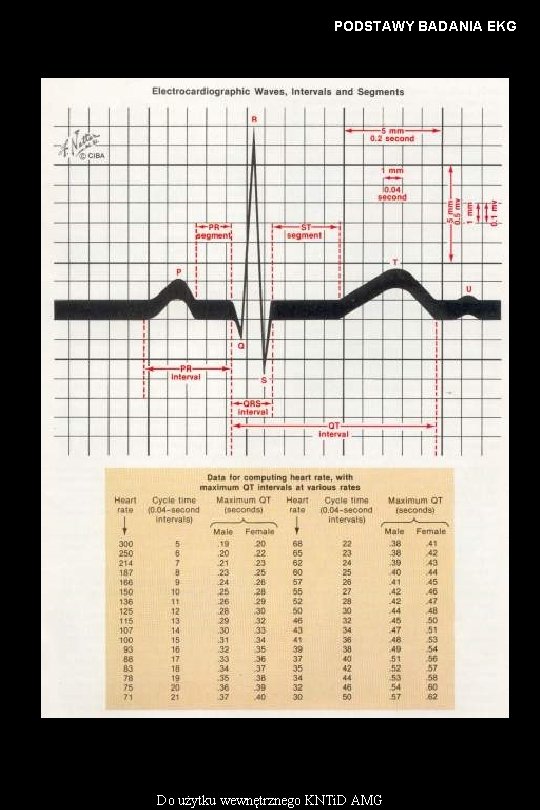 PODSTAWY BADANIA EKG Do użytku wewnętrznego KNTi. D AMG 