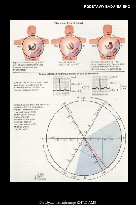 PODSTAWY BADANIA EKG Do użytku wewnętrznego KNTi. D AMG 
