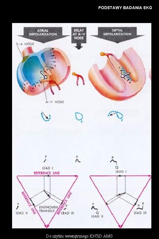 PODSTAWY BADANIA EKG Do użytku wewnętrznego KNTi. D AMG 