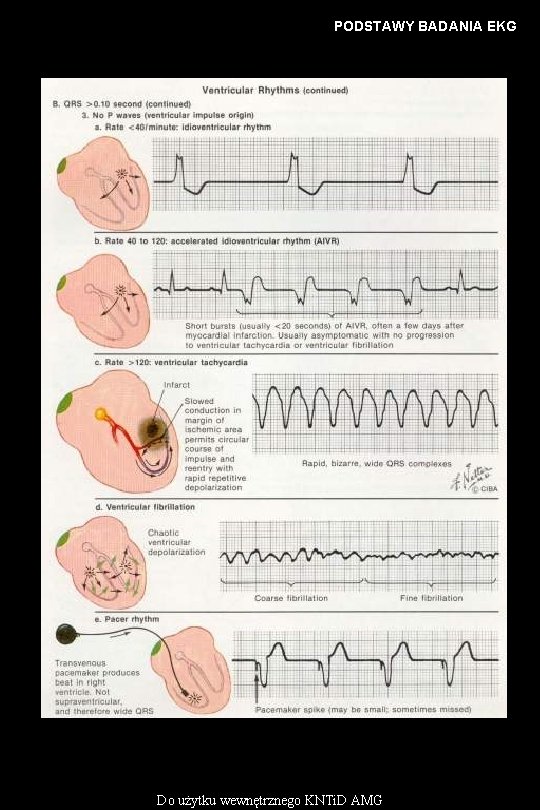 PODSTAWY BADANIA EKG Do użytku wewnętrznego KNTi. D AMG 