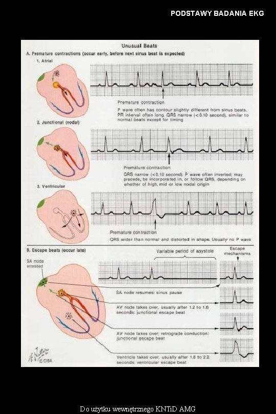 PODSTAWY BADANIA EKG Do użytku wewnętrznego KNTi. D AMG 