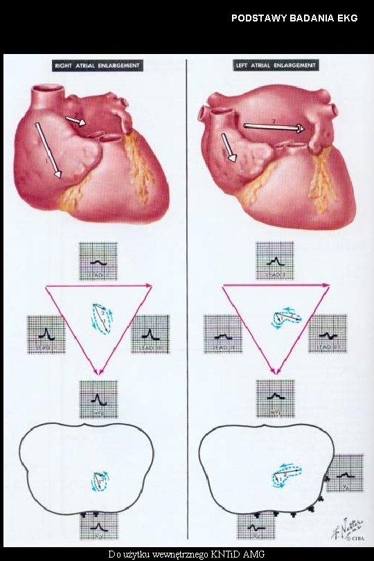 PODSTAWY BADANIA EKG Do użytku wewnętrznego KNTi. D AMG 