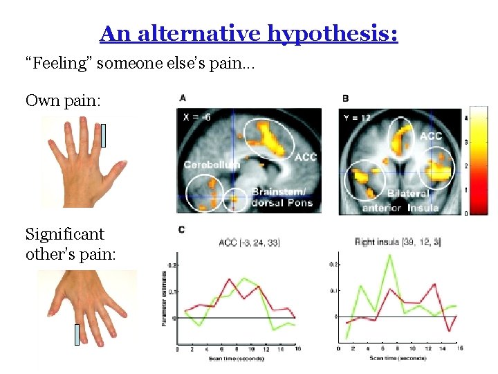 An alternative hypothesis: “Feeling” someone else’s pain. . . Own pain: Significant other’s pain: