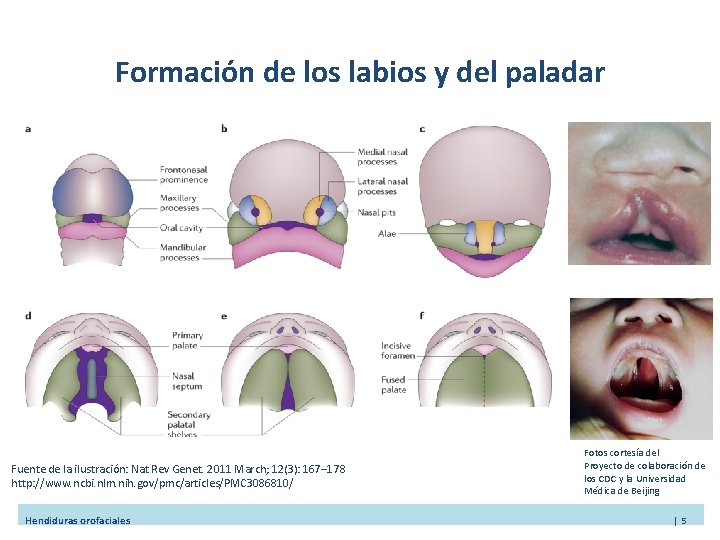 Formación de los labios y del paladar Fuente de la ilustración: Nat Rev Genet.