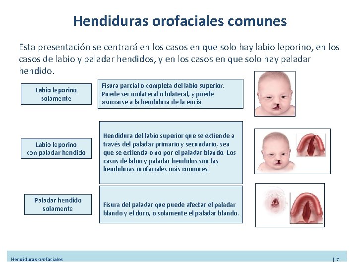 Hendiduras orofaciales comunes Esta presentación se centrará en los casos en que solo hay