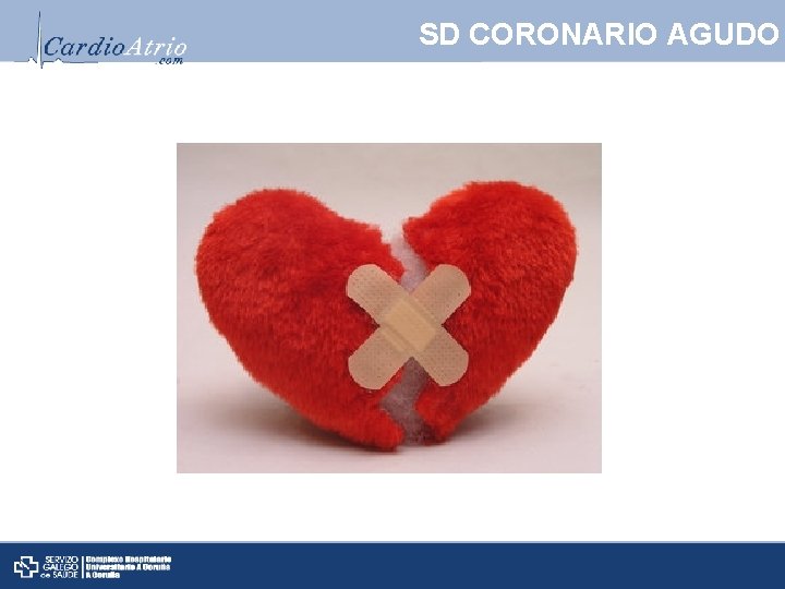 SD CORONARIO AGUDO 
