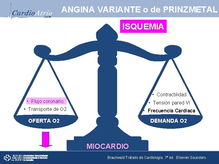 ANGINA VARIANTE o de PRINZMETAL ISQUEMIA • Contractilidad • Flujo coronario • Tensión pared