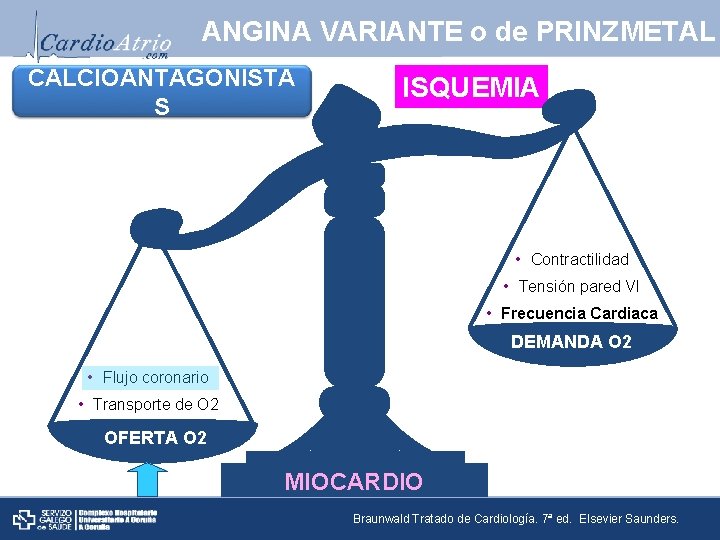 ANGINA VARIANTE o de PRINZMETAL CALCIOANTAGONISTA S ISQUEMIA • Contractilidad • Tensión pared VI
