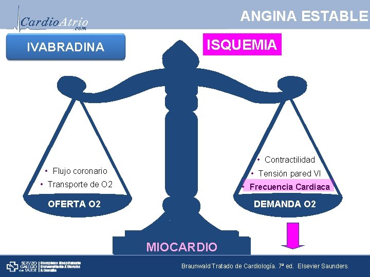 ANGINA ESTABLE IVABRADINA ISQUEMIA • Contractilidad • Flujo coronario • Tensión pared VI •