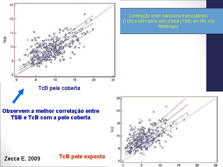 Correlação entre bilirrubina transcutânea (Tc. B) e bilirrubina sérica total (TSB) em RN sob