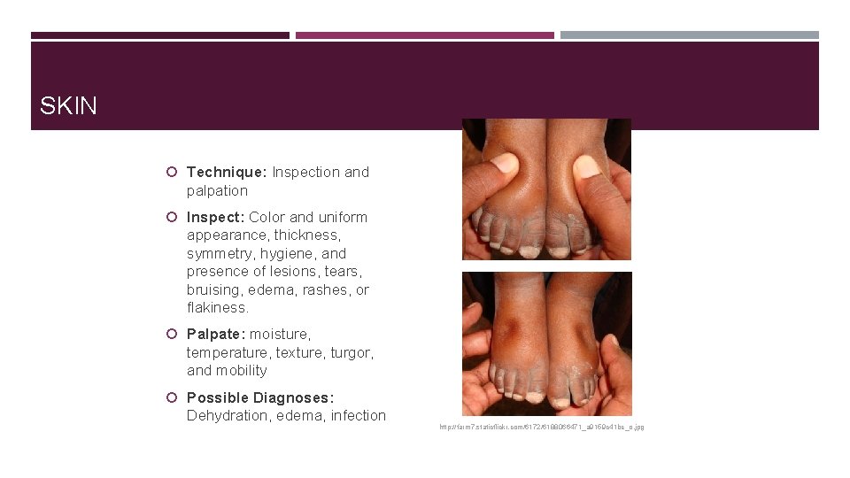 SKIN Technique: Inspection and palpation Inspect: Color and uniform appearance, thickness, symmetry, hygiene, and